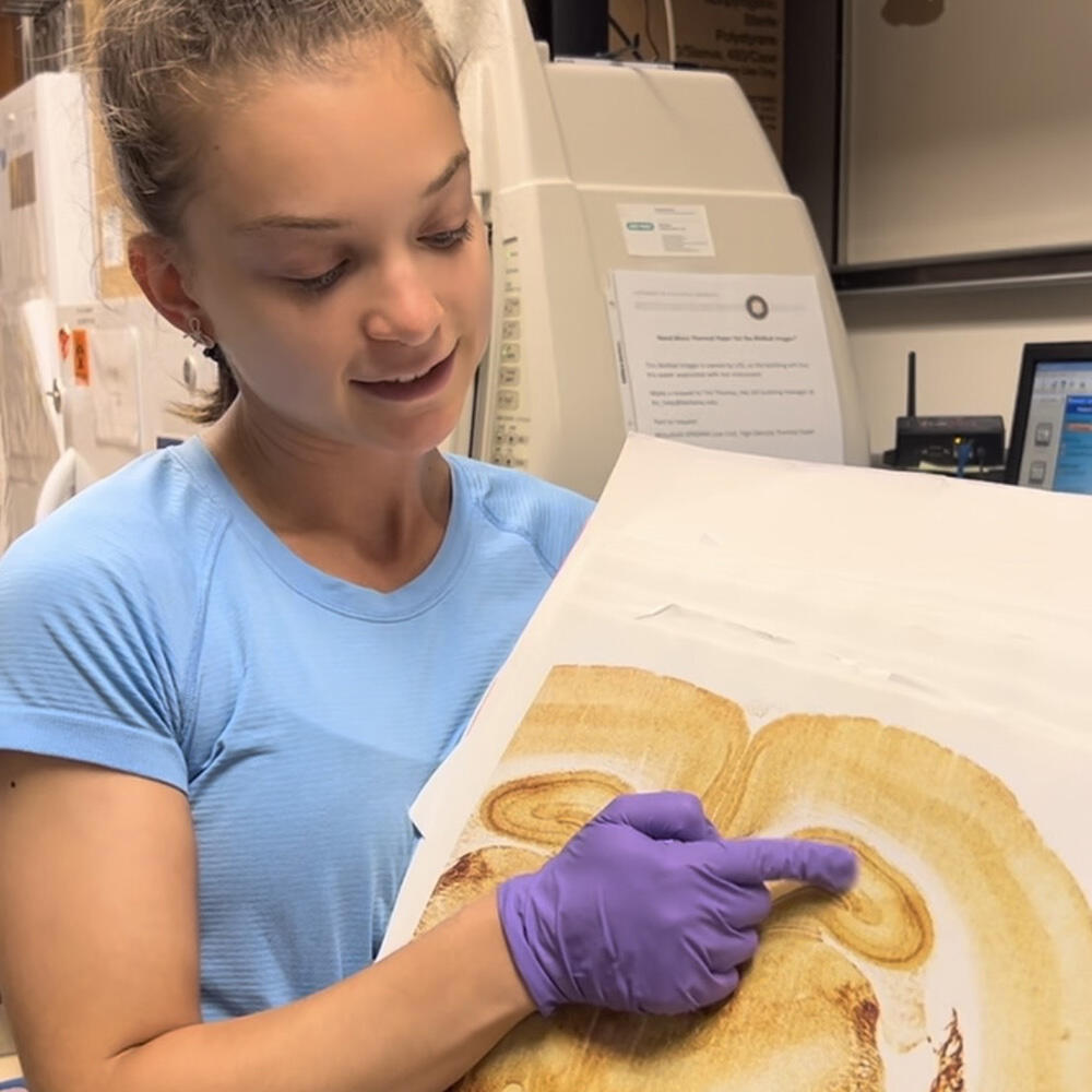 Anna Jacobowitz in a laboratory setting, pointing to a region within a large printed image of a brain slice with her gloved hand.